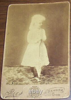 ALBINO SIBLINGS 1800s antique Cabinet card photo lot 3 Sylvia AND 1 William Neff