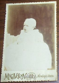 ALBINO SIBLINGS 1800s antique Cabinet card photo lot 3 Sylvia AND 1 William Neff